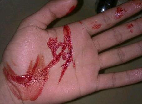 女生手割伤照片流血图片